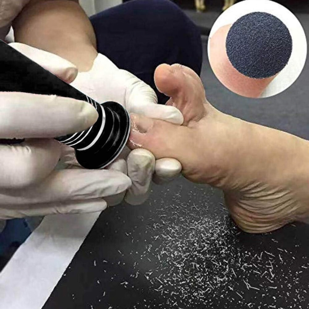 Electric Foot File FCR-02 | Callus Remover with 60 Replacement Discs