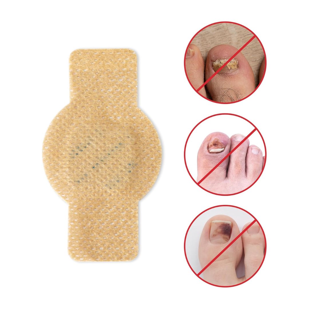 Fungal Nail Patches – 21 patches