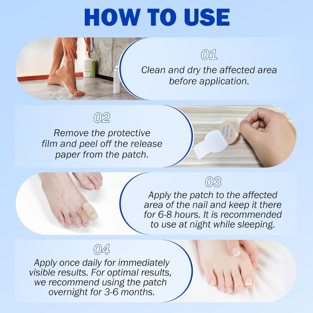 Fungal Nail Patches – 21 patches