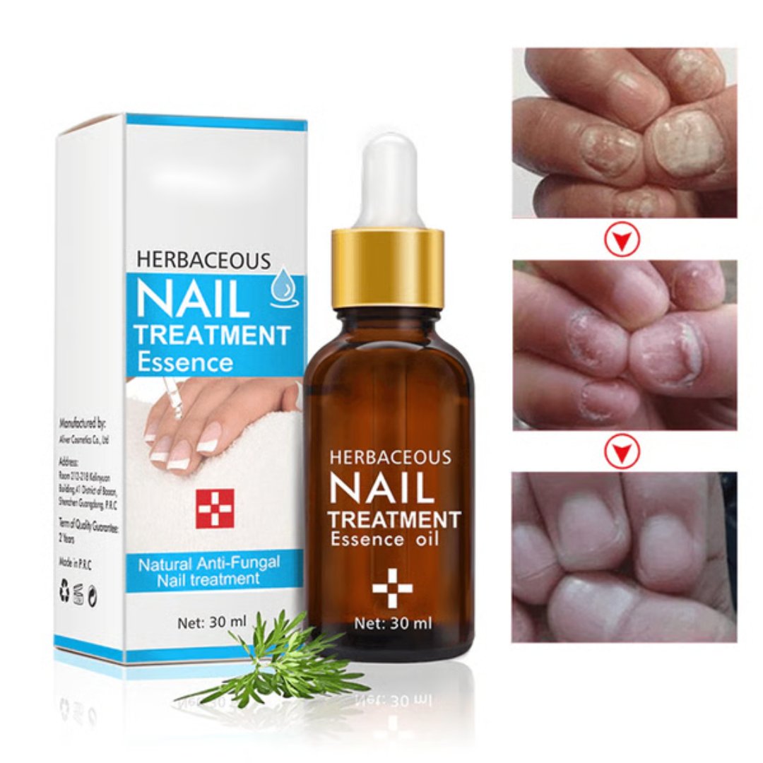 Herbaceous Nail Treatment Essence 30ml – Natural Anti-Fungal Treatment