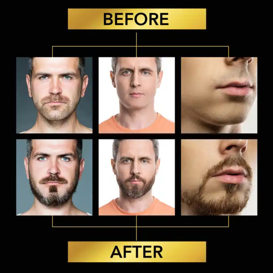 Sefudun Beard Growth Serum Set | Beard Thickening & Hair Growth Kit 60ml