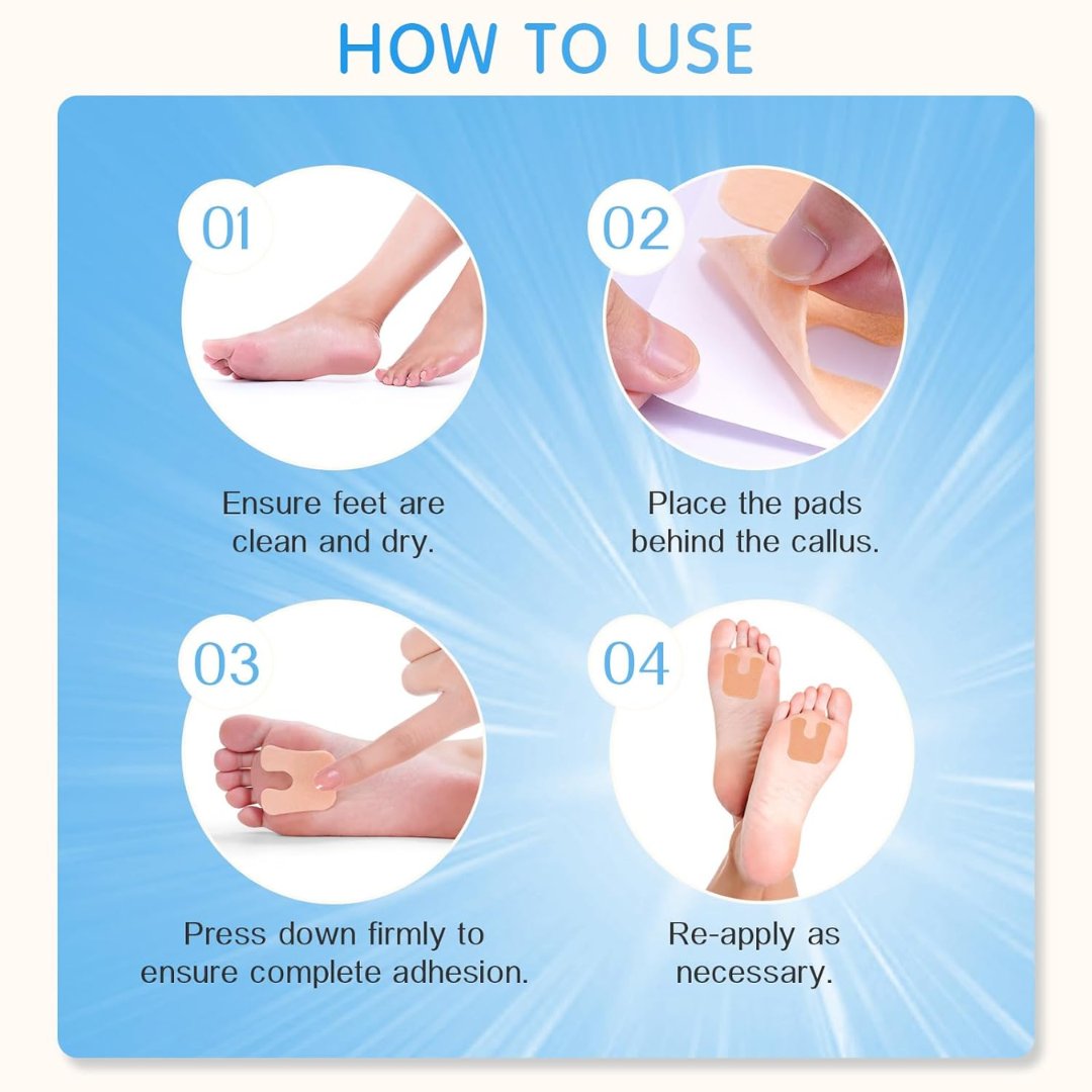U-Shaped Felt Callus Relief Pads – 48 pcs